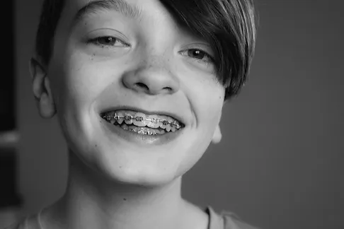 Traditional Braces