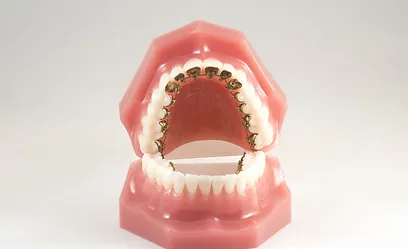 Personalized Orthodontic Care